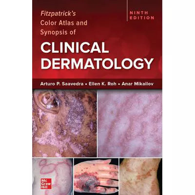 Fitzpatrick's Color Atlas and Synopsis of Clinical Dermatology, 9/e